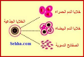   Aplastic Anemia Aplastic-Anemia4.jpg