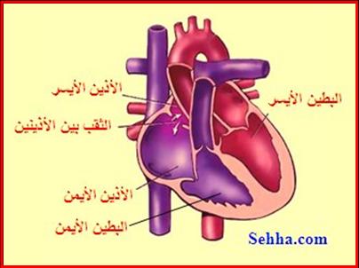        What Is Atrial Septal Defect