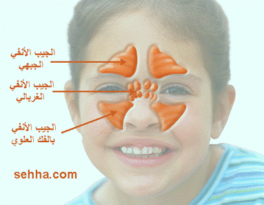 علاج التهاب الجيوب الأنفية عند الأطفال 