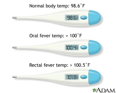 الحمى - السخونة - السخونيه - ارتفاع درجة حرارة الجسم Fever