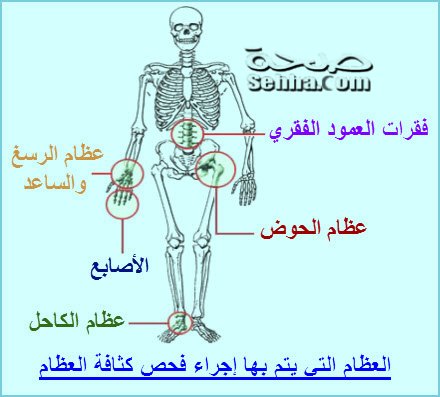 العظام التي يتم بها إجراء فحص كثافة العظام