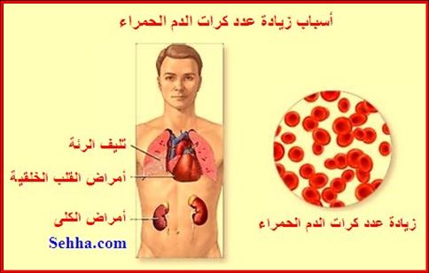 أسباب الزيادة في عدد خلايا الدم الحمراء