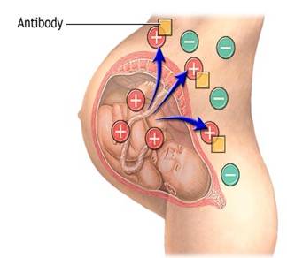 العامل الريصي Rhesus factor وأثره على الحمل والأجنة والمواليد