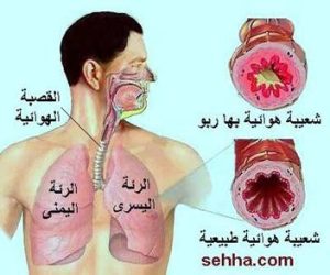القصبات الهوائية والربو