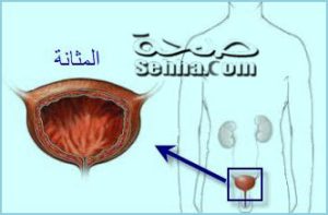 المثانة
